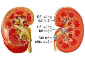 Bán Kim Tiền Thảo Tại Bắc Kạn